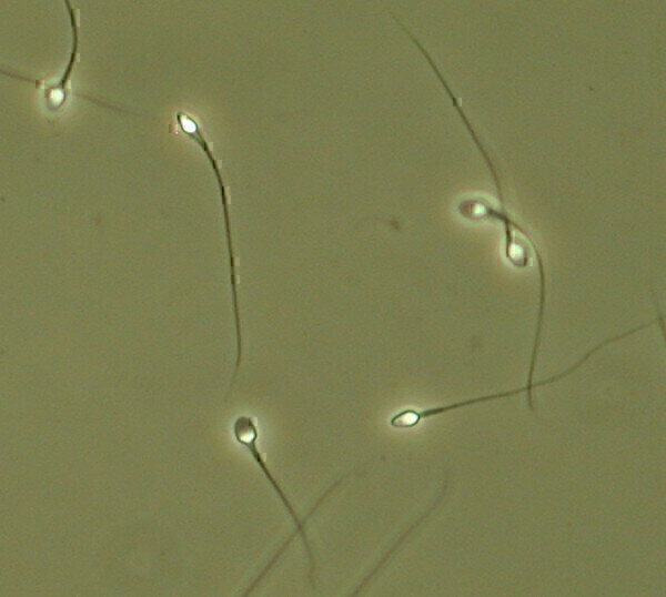 Temperature Controlled Warm Stages Chosen for Sperm Motility in Human ...