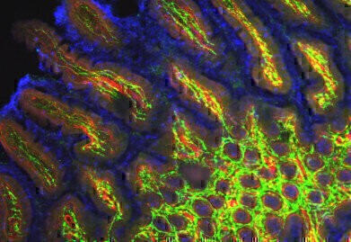 Further Secondary Antibody Conjugates Offered