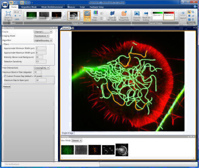 Software with Comprehensive Neuronal Morphology Module Introduced