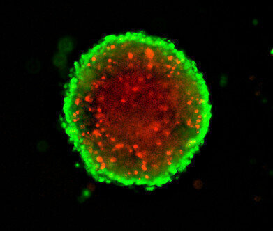 3D Spheroid Assays for Cancer Drug Screening
