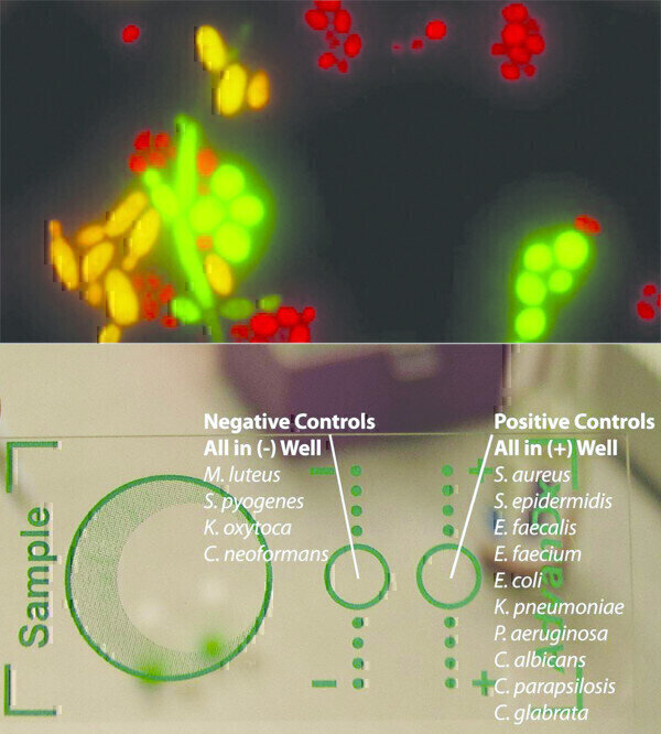 Yeast Species Identification from Positive Blood Culture in just 20 ...