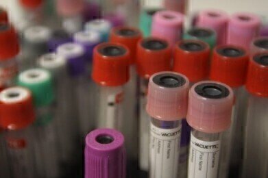 Blood test can predict Alzheimer's disease