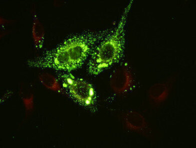 New Monoclonal Antibodies to Mumps Virus
