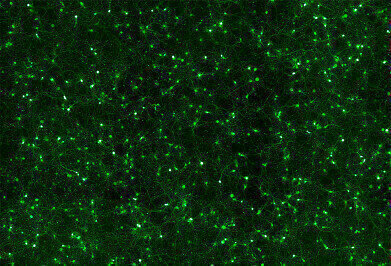 Highly Efficient Neural Transfection Reagent
