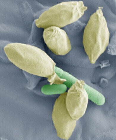 New Insights into Clostridium Spores
