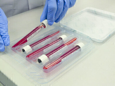 How Quickly Can You Pack 5 Blood Tubes in UN3373 Compliant Packaging?
