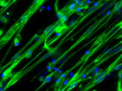 Sourcing, growing, and differentiating human skeletal muscle cells