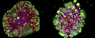  iPSC culture techniques for drug discovery and therapeutics