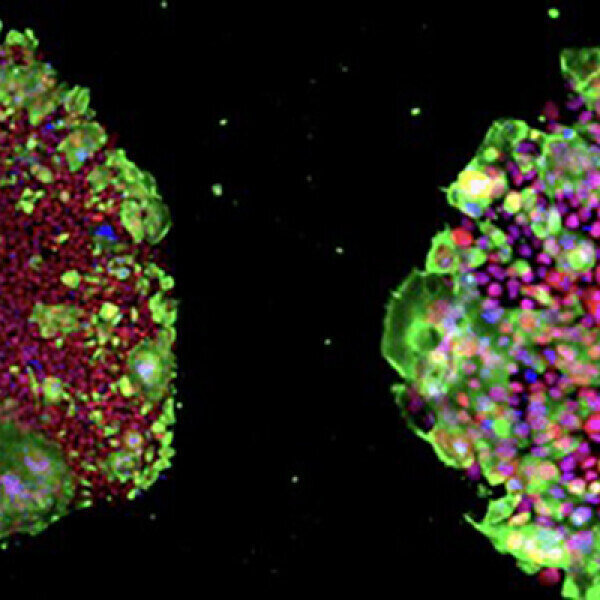 iPSC culture techniques for drug discovery and therapy Labmate Online