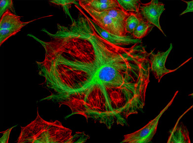 Direct translocation of proteins into living cells