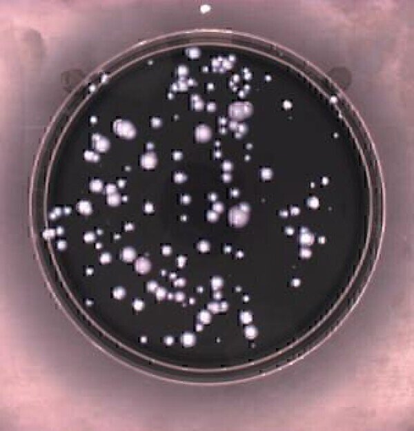 Speeding up Detection of Legionella in Contaminated Water Supplies ...